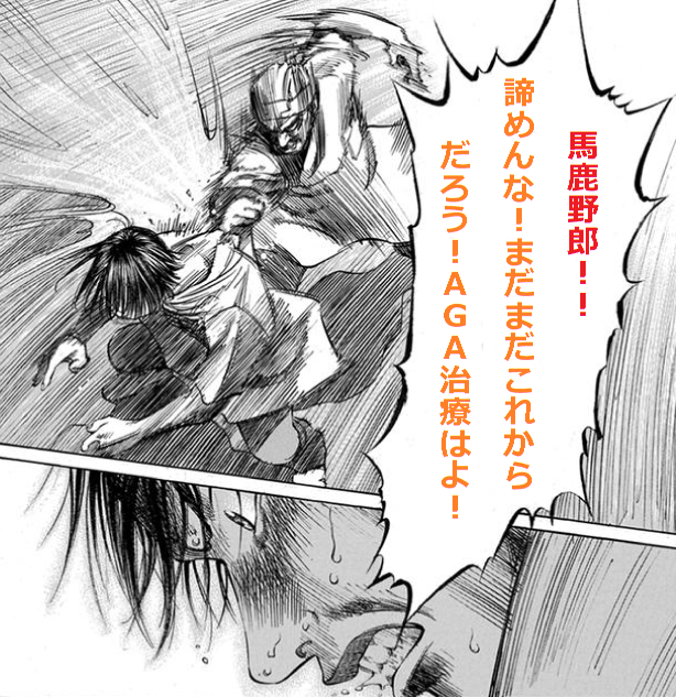 ��N��AGA���߂Ȃ�