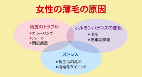 女性薄毛問題