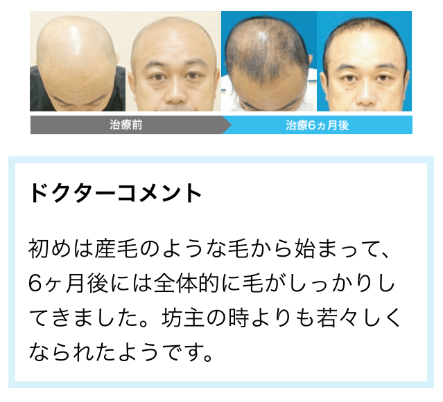 AGA���Î���