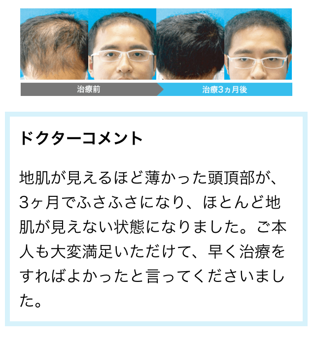 AGA���Î���