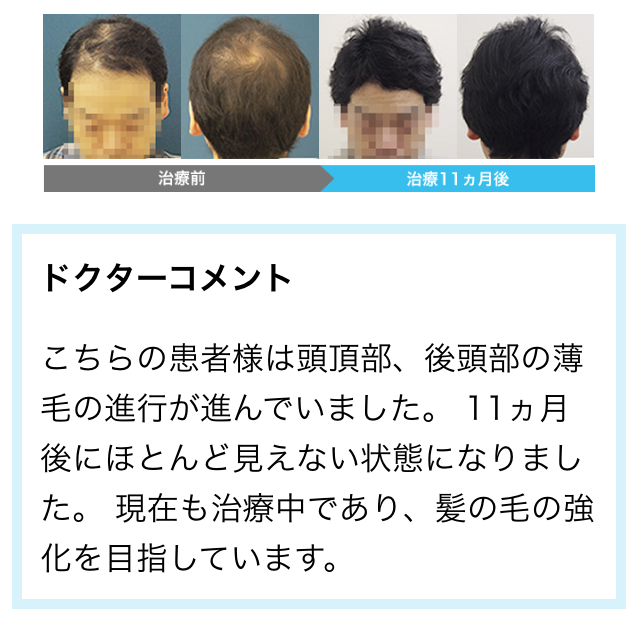 AGA���Î���