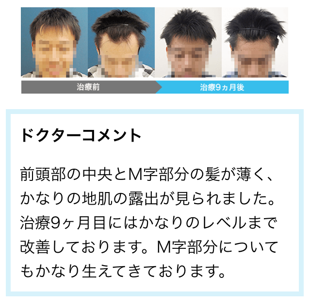 AGA���Î���