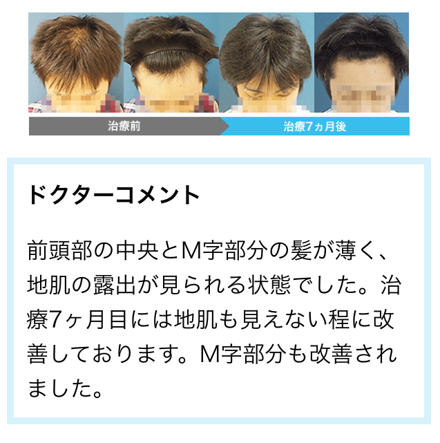 AGA���Î���