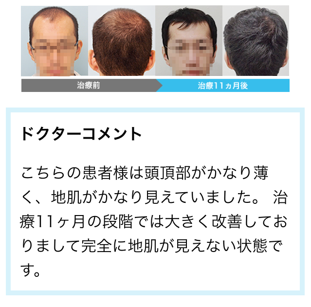 AGA���Î���