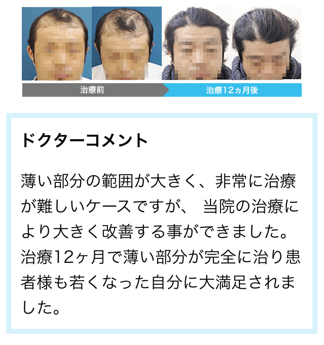 AGA���Î���