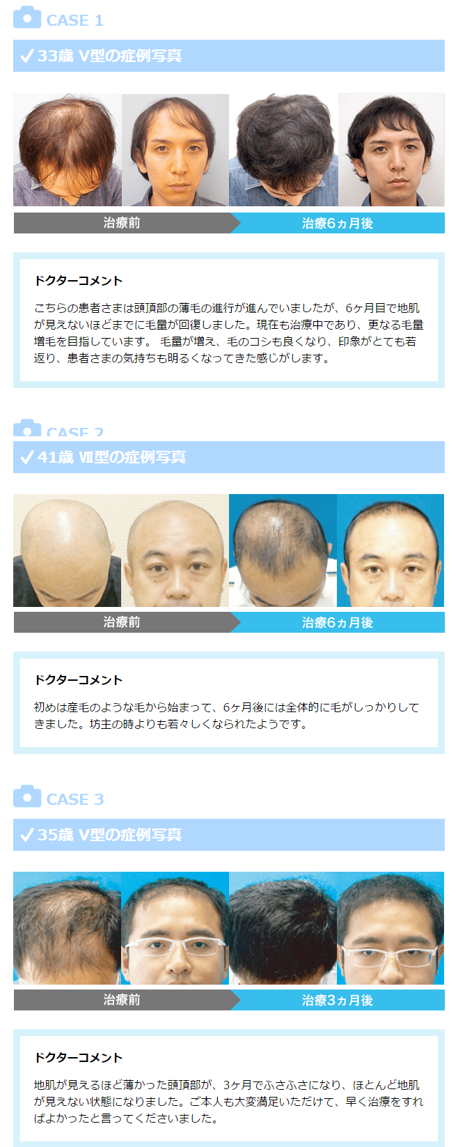 AGA���Î���