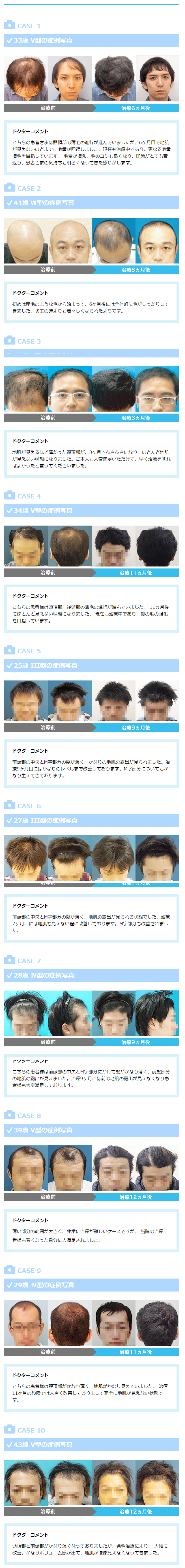 AGA���Î���